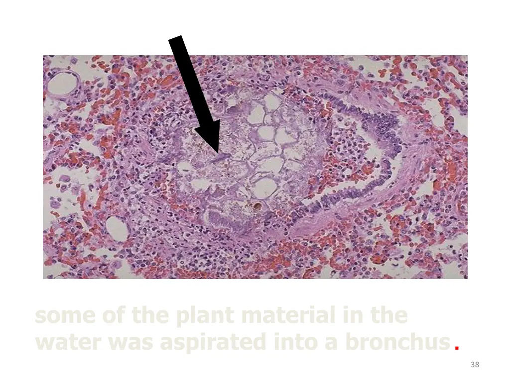 some of the plant material in the water