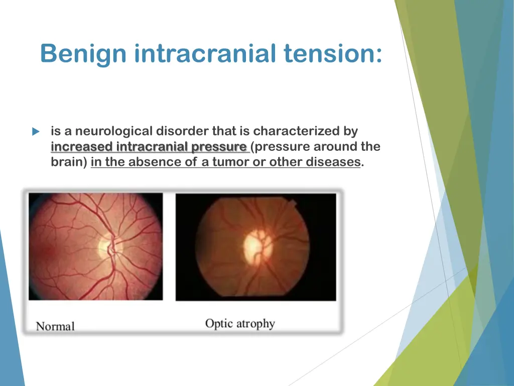benign intracranial tension