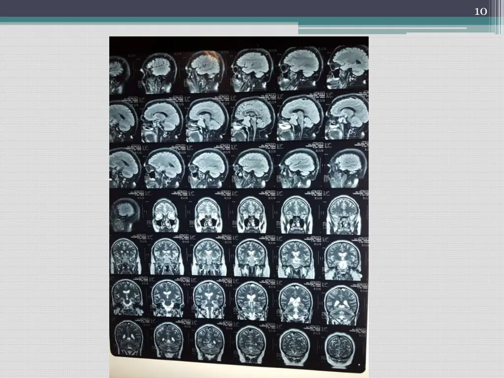 slide10