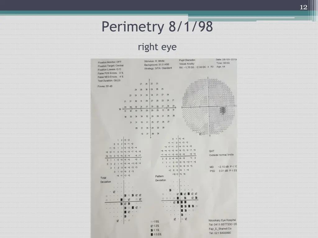 slide12