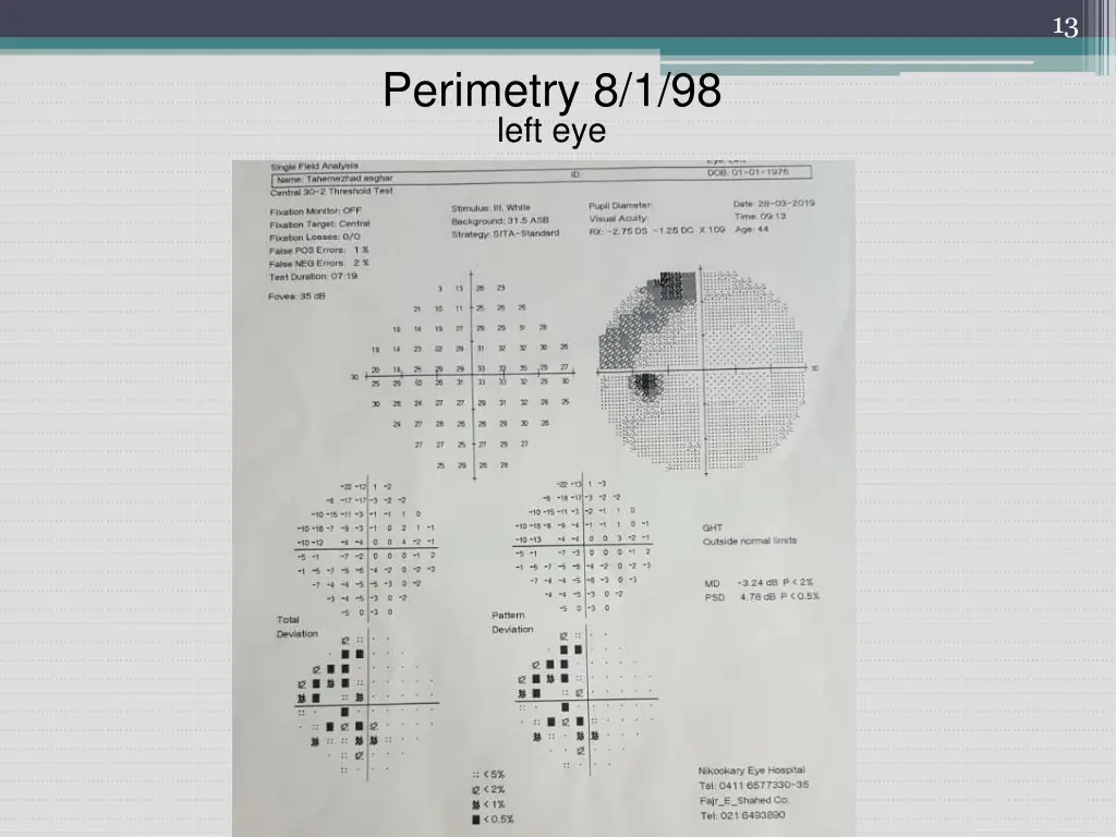 slide13