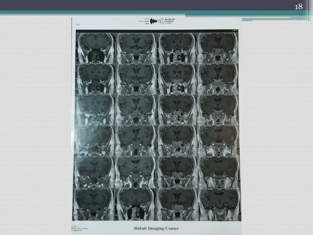 slide18