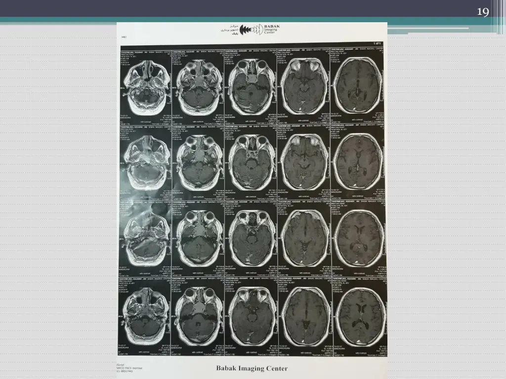 slide19