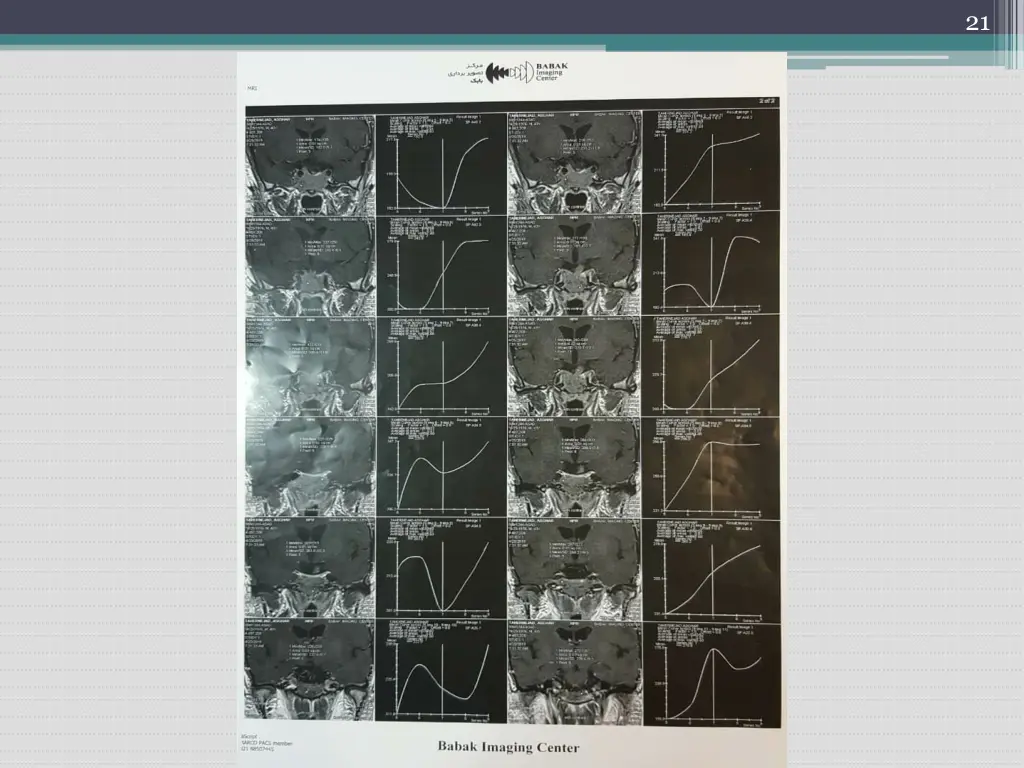 slide21