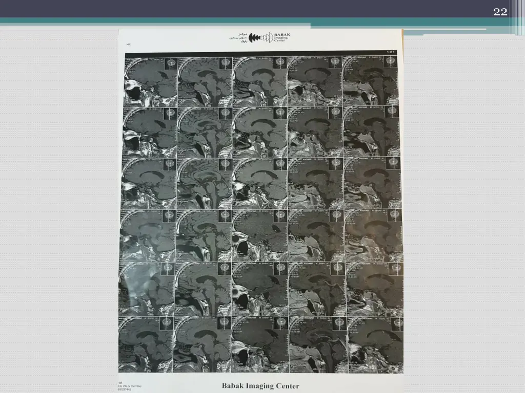 slide22