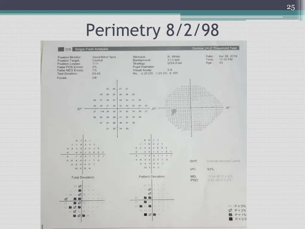 slide25