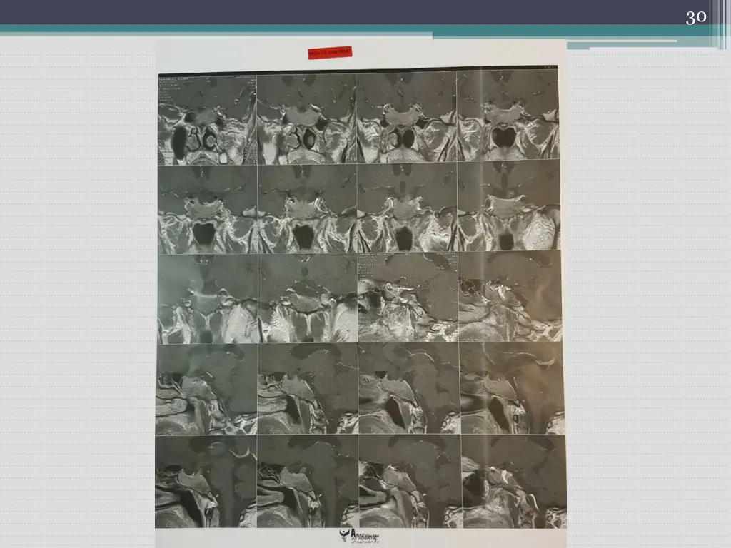 slide30