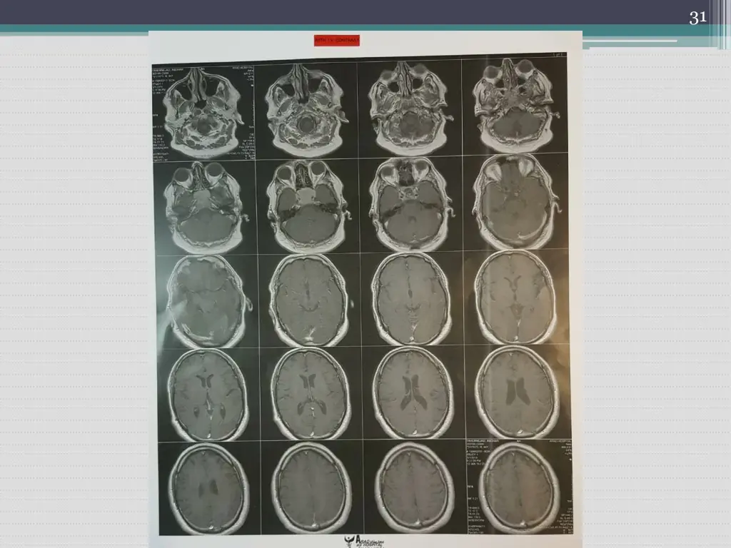 slide31