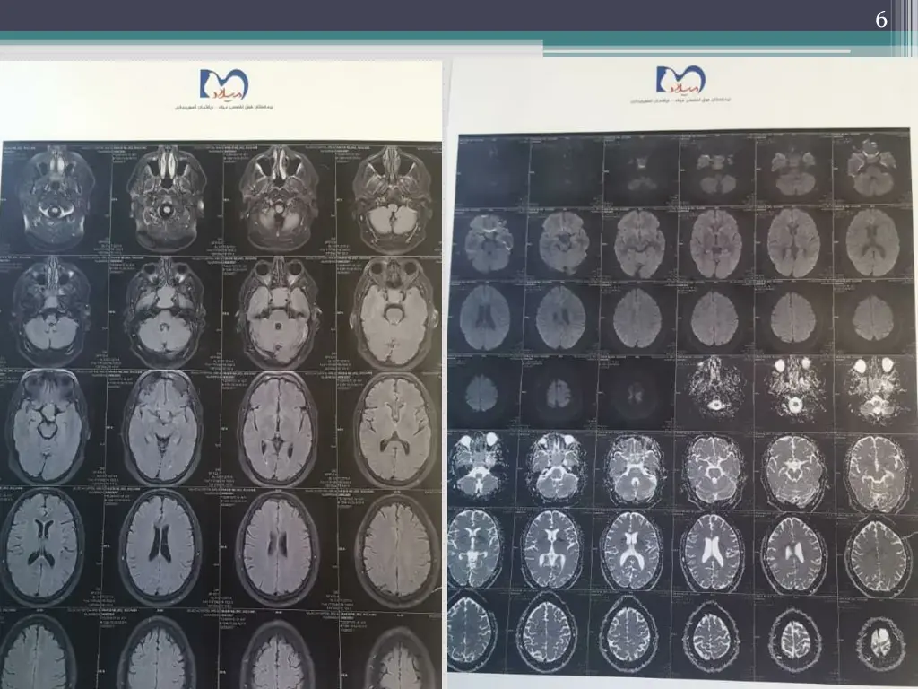 slide6