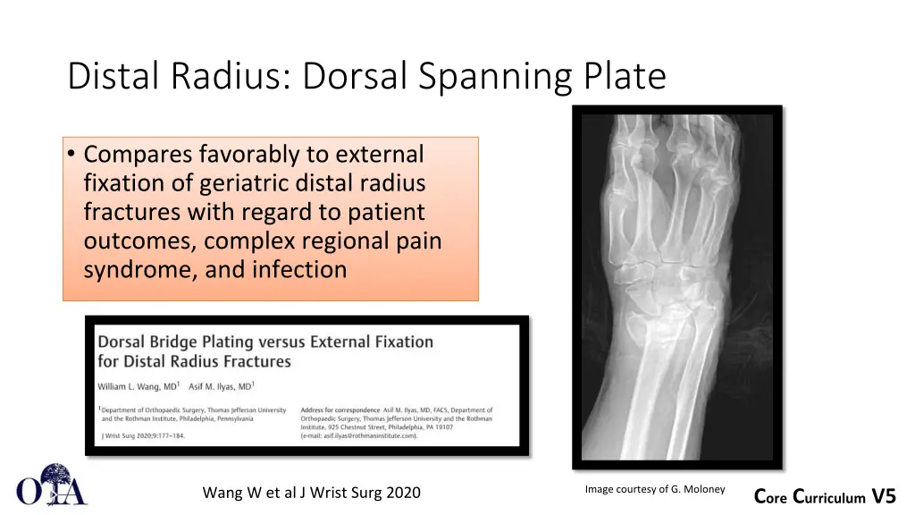 distal radius dorsal spanning plate