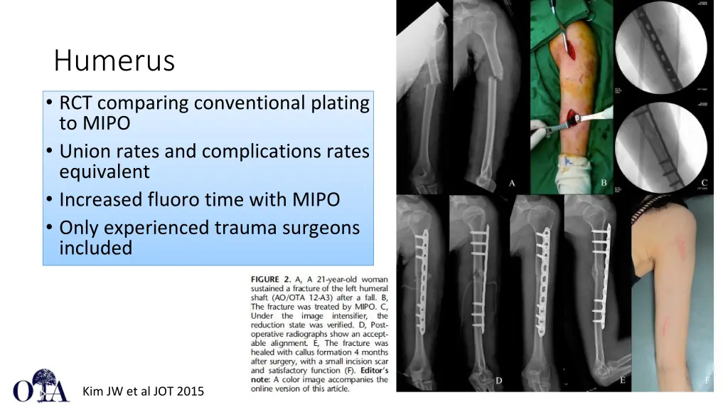 humerus 2