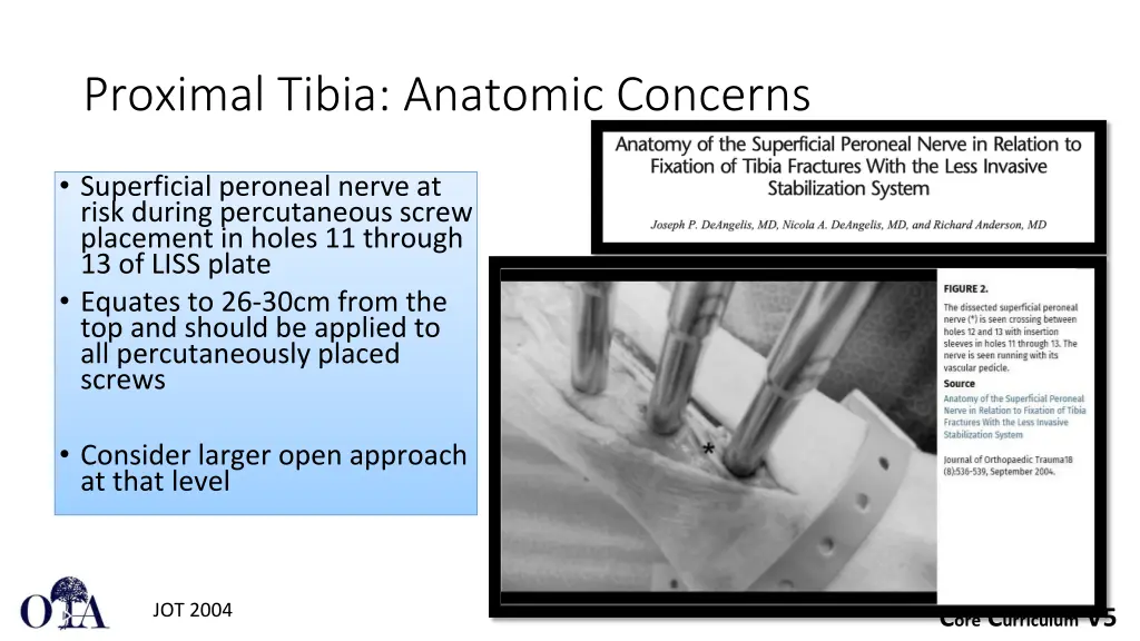 proximal tibia anatomic concerns