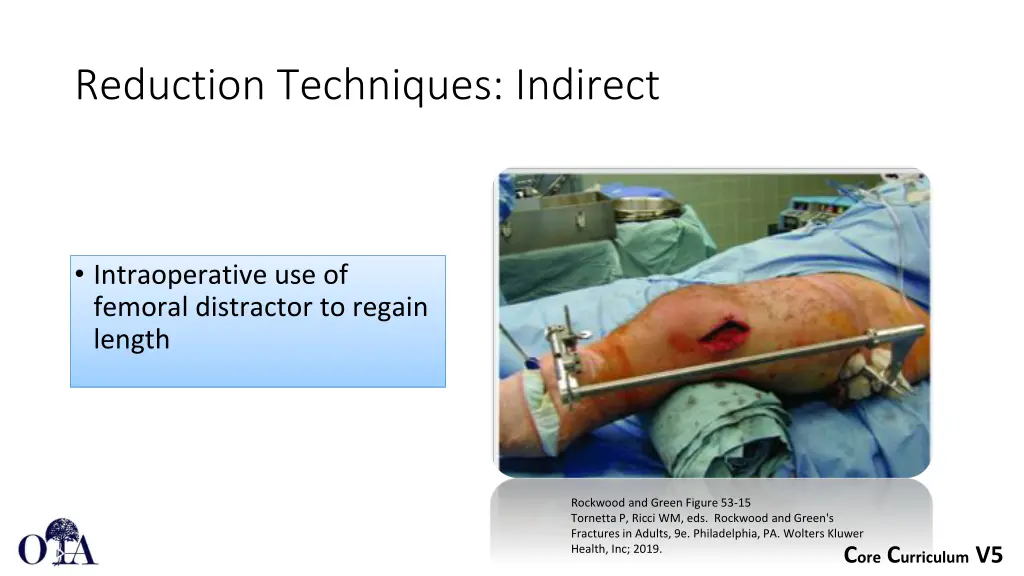 reduction techniques indirect 1