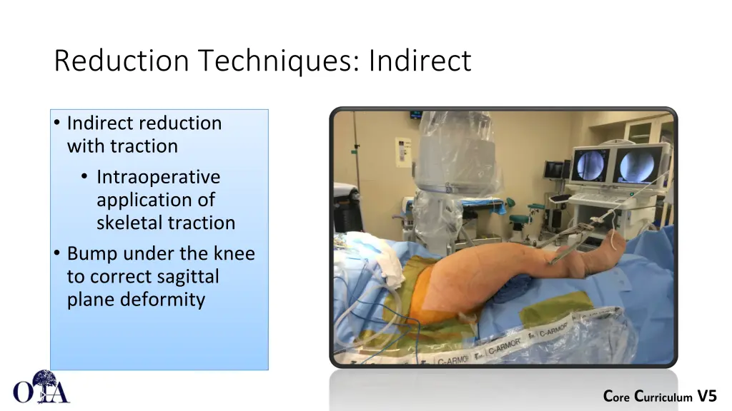 reduction techniques indirect