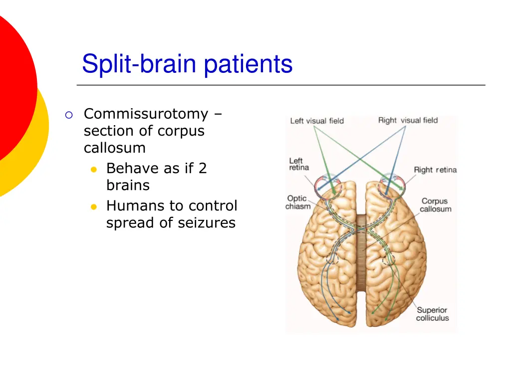 split brain patients