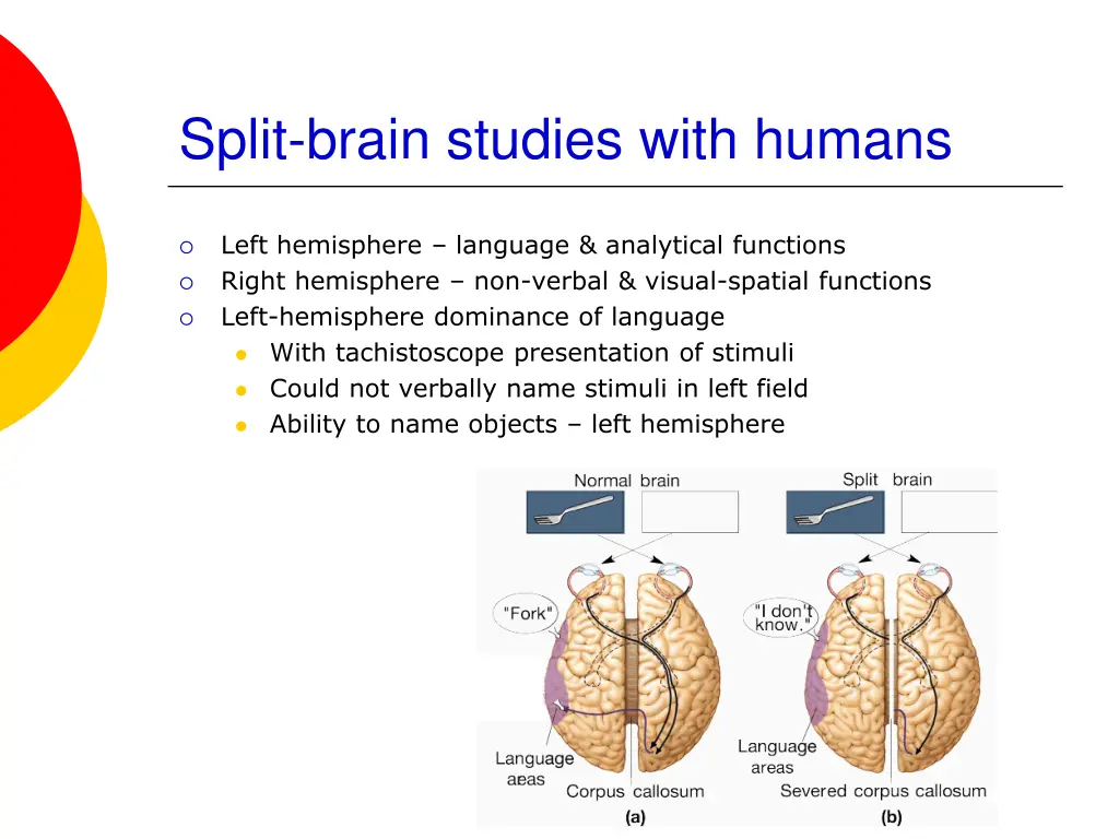 split brain studies with humans
