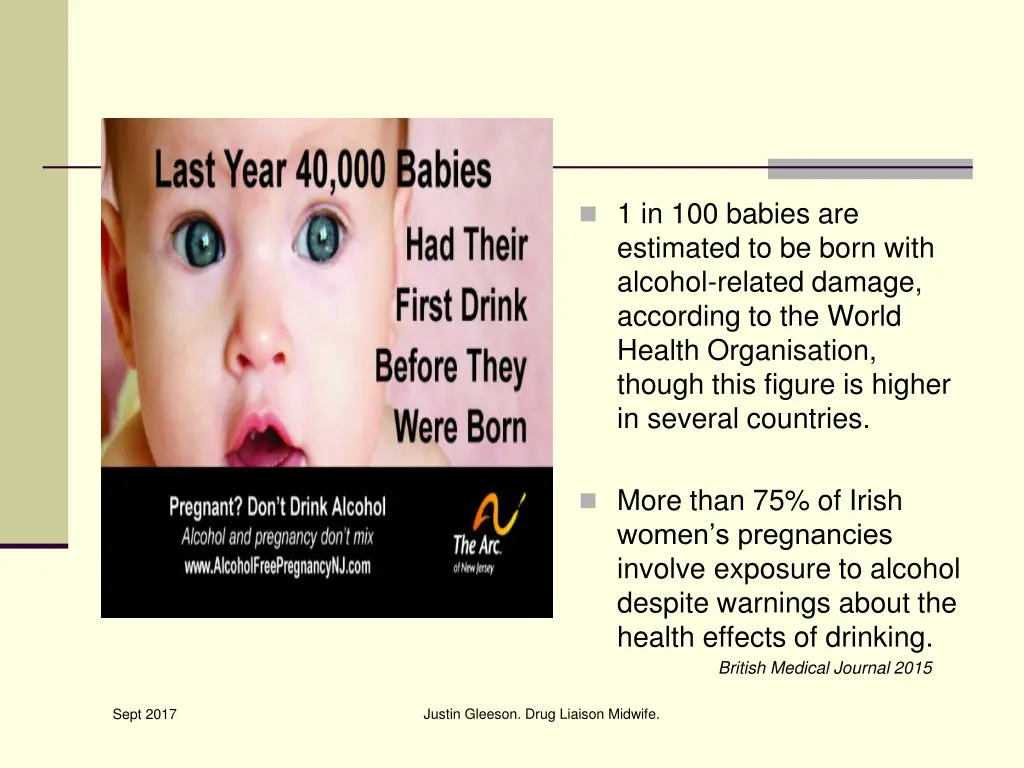 1 in 100 babies are estimated to be born with