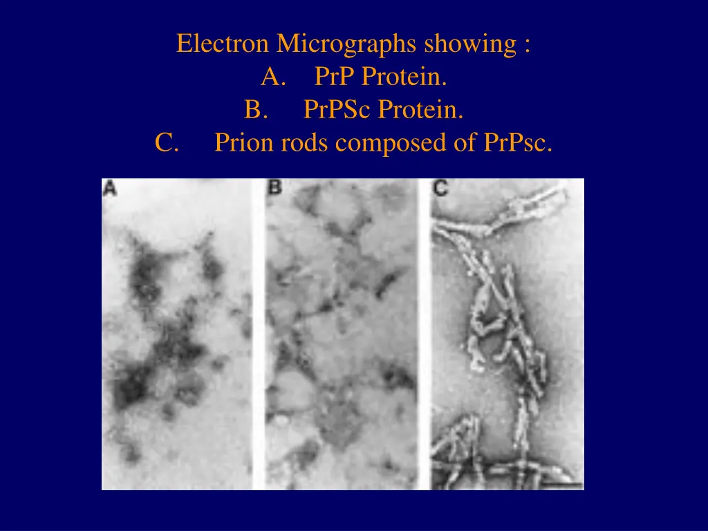 electron micrographs showing a prp protein