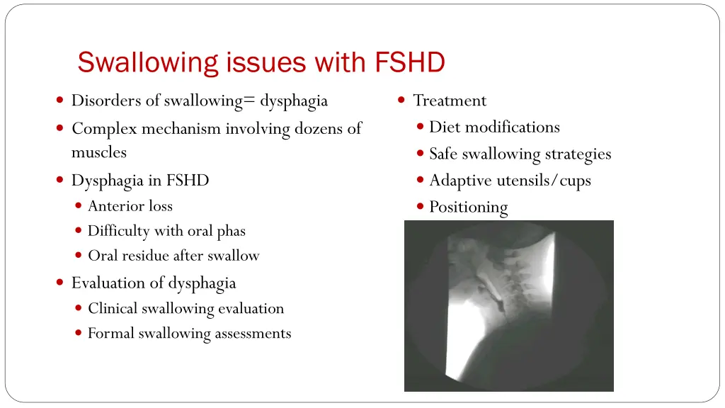 swallowing issues with fshd