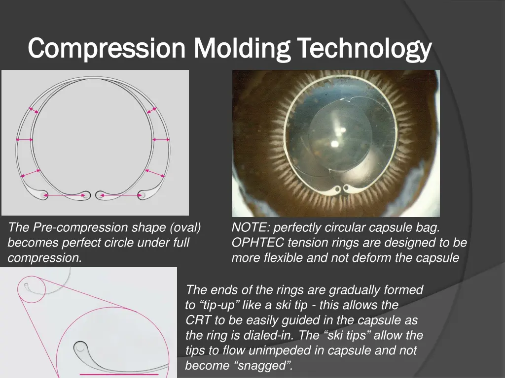 compression molding technology compression 1