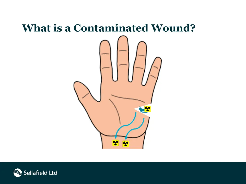 what is a contaminated wound