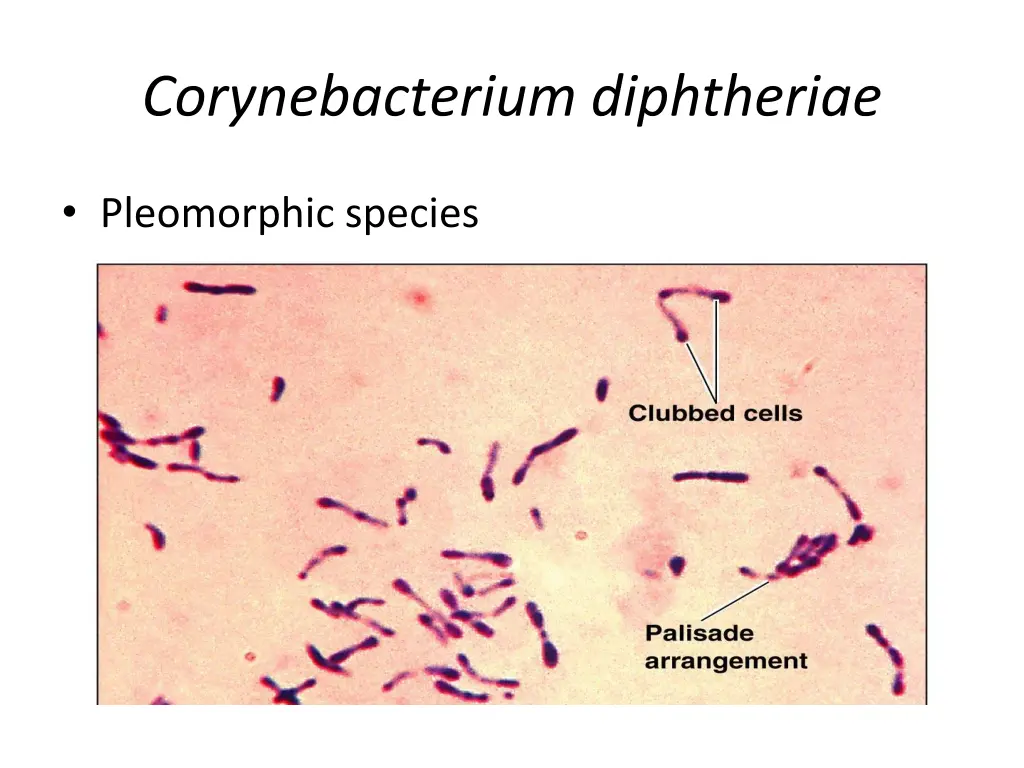corynebacterium diphtheriae