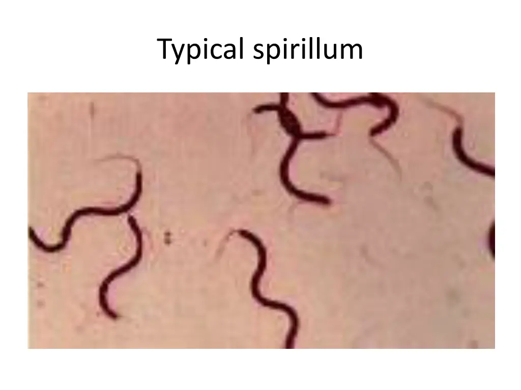 typical spirillum