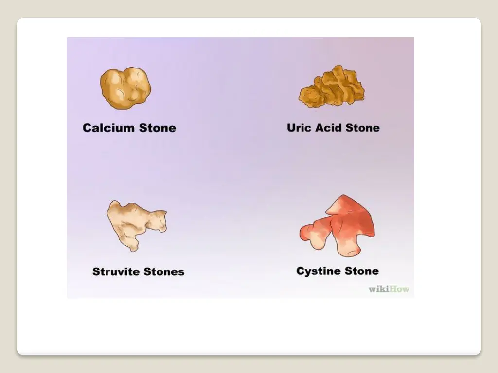 slide16