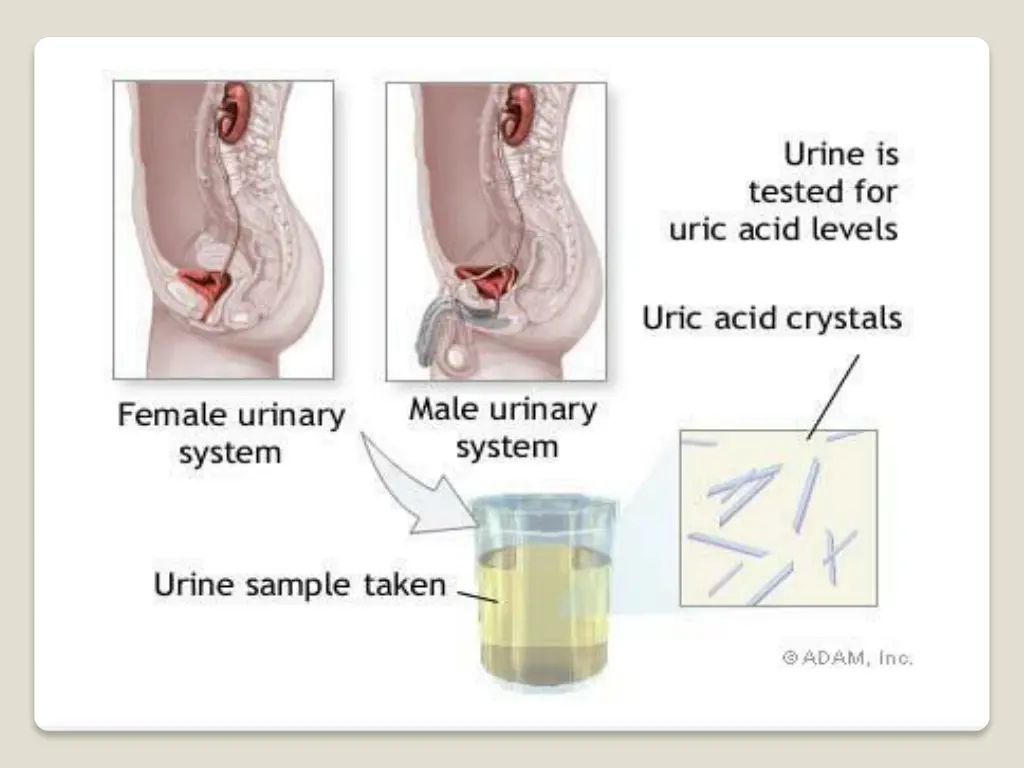slide19