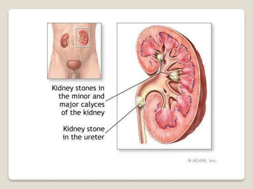 slide23