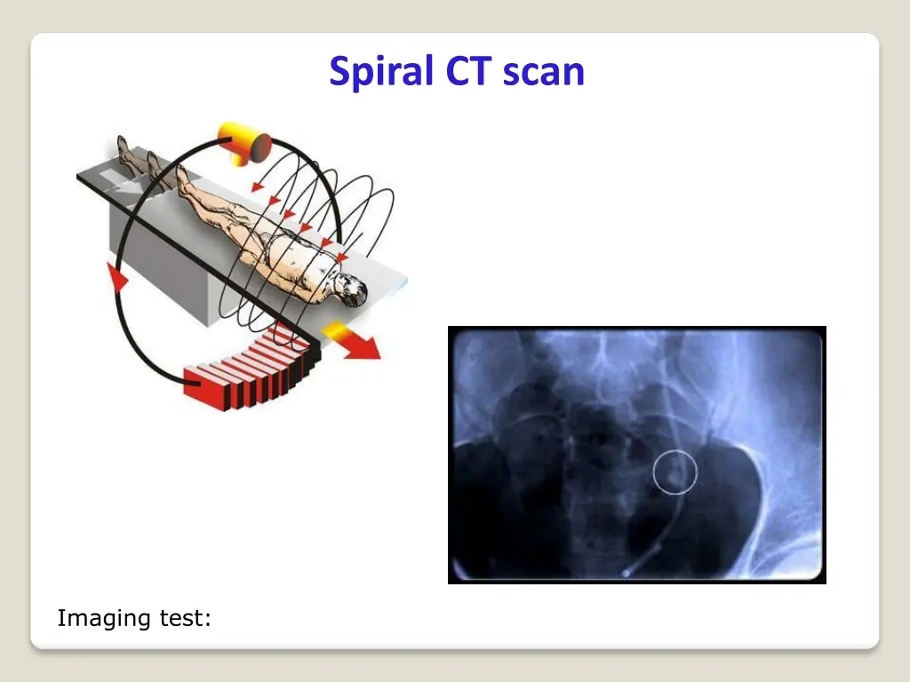 spiral ct scan