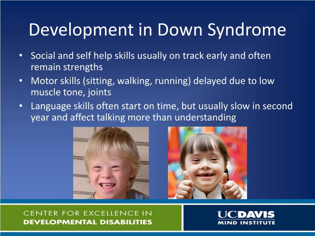 development in down syndrome