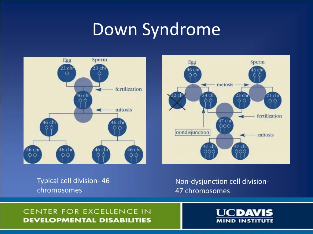 down syndrome 2