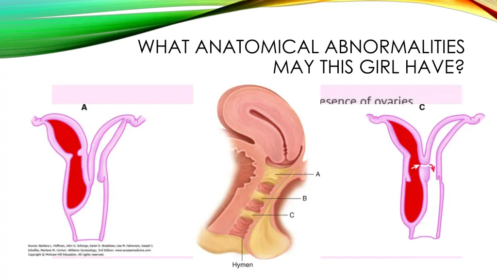 what anatomical abnormalities may this girl have 1