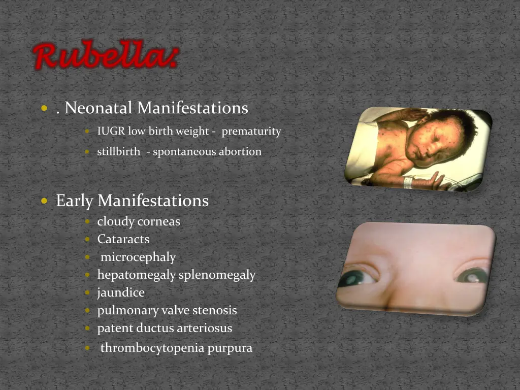 rubella rubella