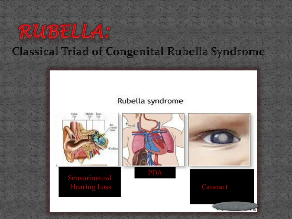slide29