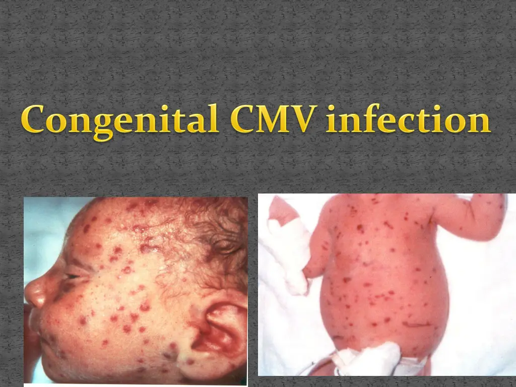 slide35