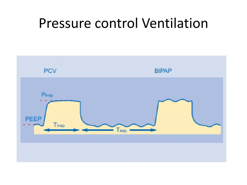 pressure control ventilation