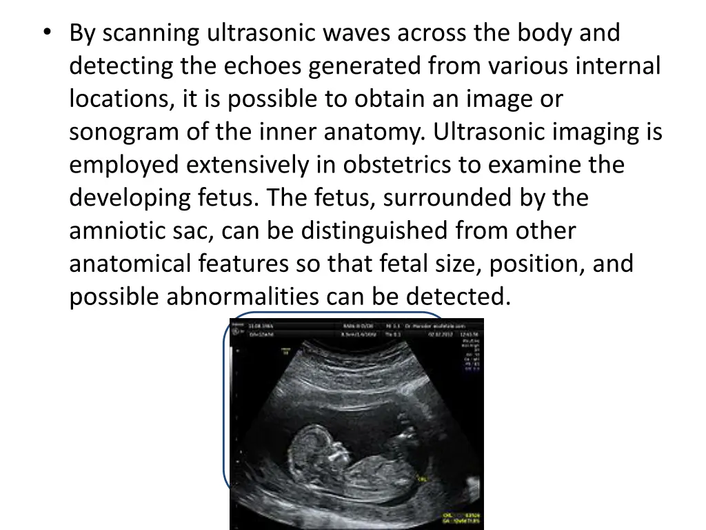 by scanning ultrasonic waves across the body