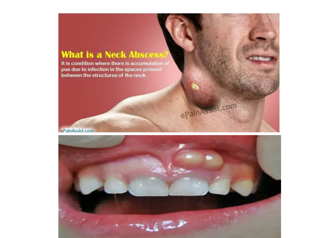 slide7