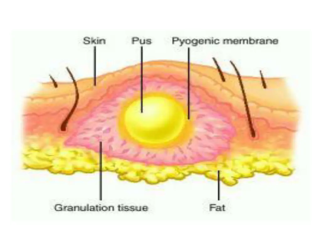 slide8