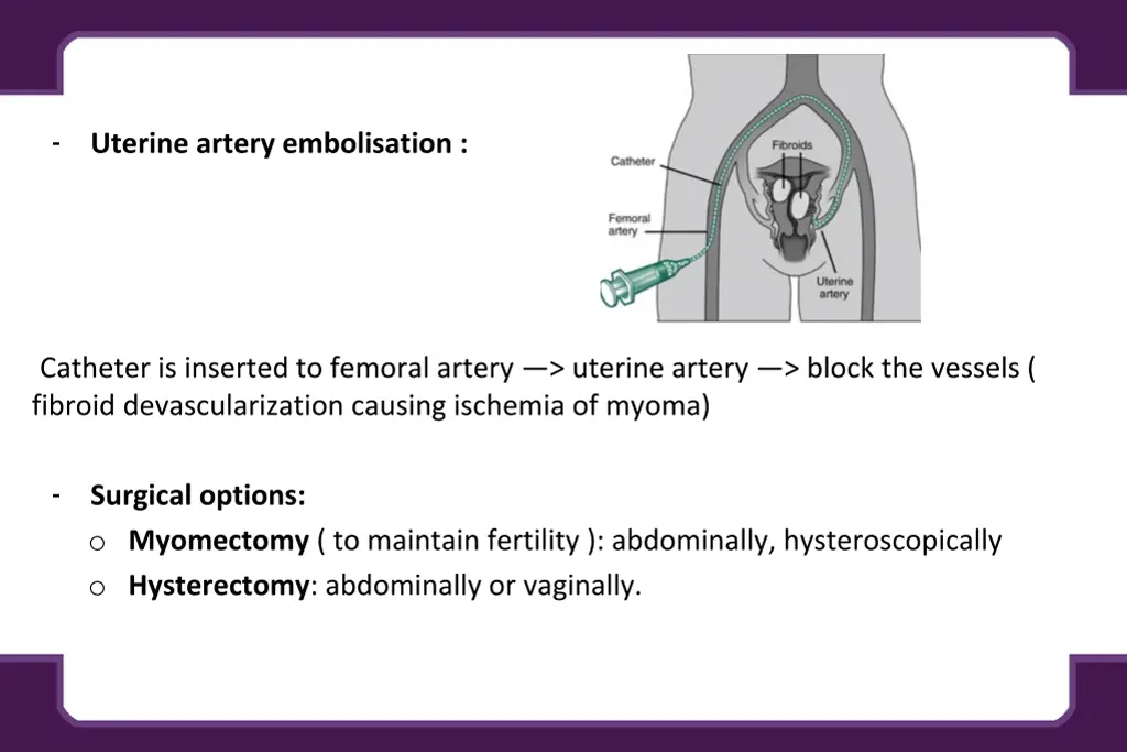 slide7