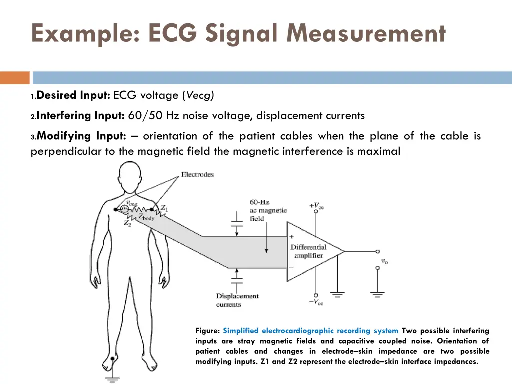 example ecg signal measurement