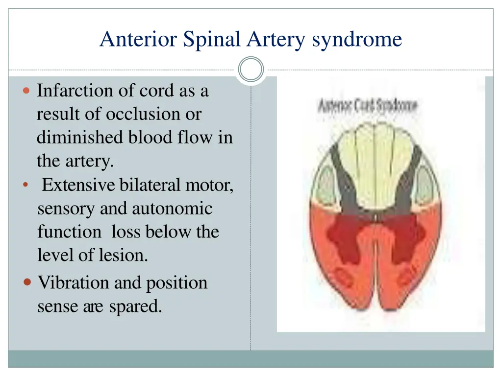 anterior spinal artery syndrome