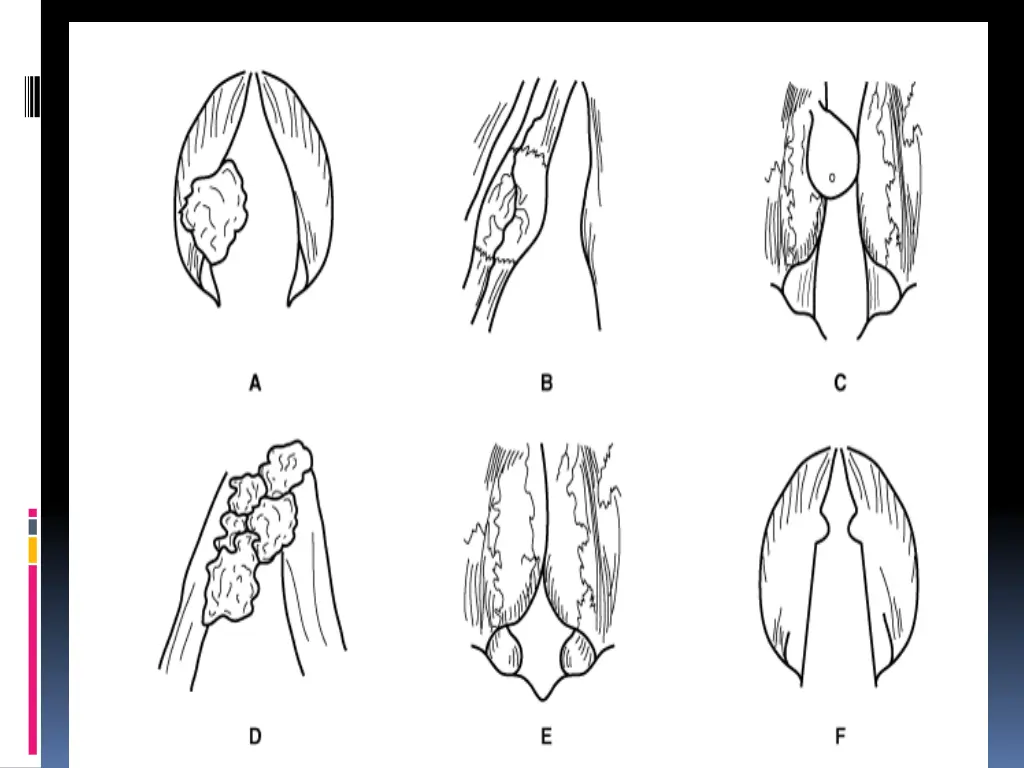 slide10