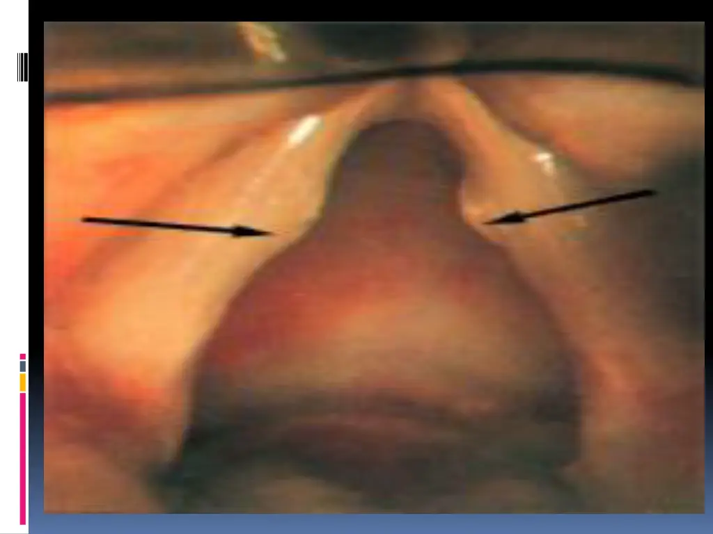 slide27