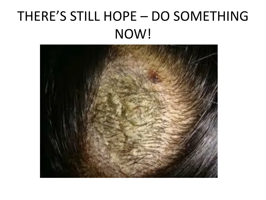 there s still hope do something now