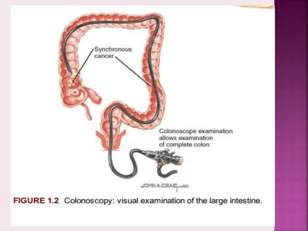 slide6