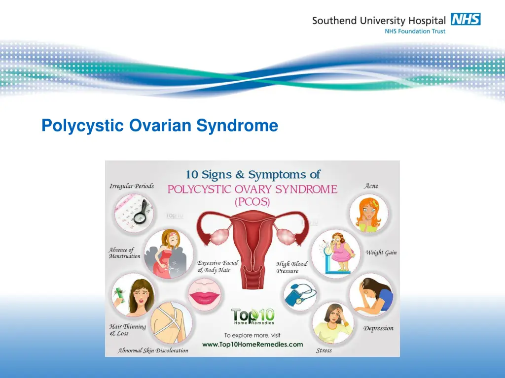si polycystic ovarian syndrome 1