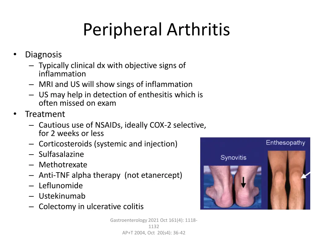 peripheral arthritis 1